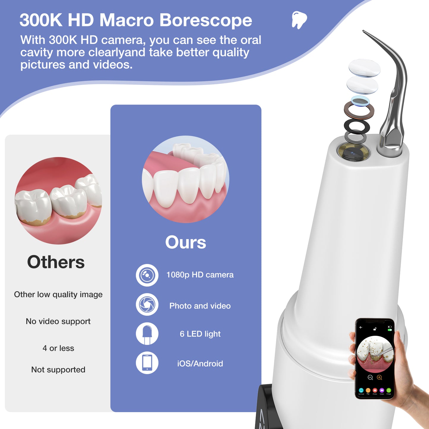 Dlopede Plaque Remover for Teeth with Camera, Ultrasonic Tooth Cleaner with 5 Modes,Blu-Ray Storage Compartment, Wall Mounted Base, Dental Mirror & 2 Cleaning Heads Electric Teeth Cleaning Kit